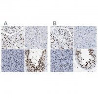 Anti-CCAR2 antibody produced in rabbit 