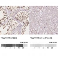 Anti-CCDC138 antibody produced in rabbit 