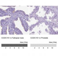 Anti-CCDC151 antibody produced in rabbit 