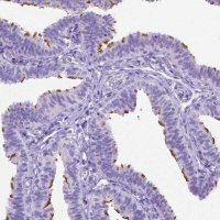 Anti-CCDC151 antibody produced in rabbit 