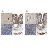 Anti-CCDC155 antibody produced in rabbit 