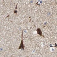 Anti-CCDC155 antibody produced in rabbit 