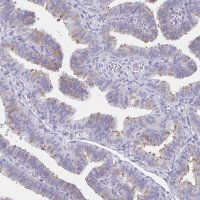 Anti-CCDC17 antibody produced in rabbit