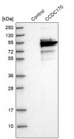 Anti-CCDC170 antibody produced in rabbit 