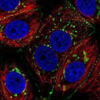 Anti-CCDC170 antibody produced in rabbit 