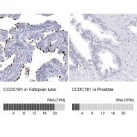 Anti-CCDC181 antibody produced in rabbit 