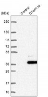 Anti-CCDC190 antibody produced in rabbit HPA028579-100UL
