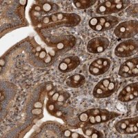 Anti-CCDC190 antibody produced in rabbit HPA028579-100UL
