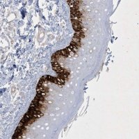 Anti-CCDC24 antibody produced in rabbit 