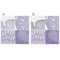 Anti-CCDC39 antibody produced in rabbit 