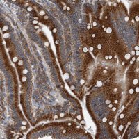 Anti-CCDC47 antibody produced in rabbit