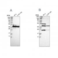 Anti-CCDC51 antibody produced in rabbit 