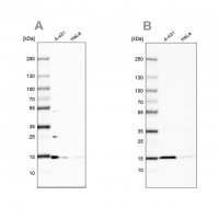 Anti-CCDC58 antibody produced in rabbit HPA051965-100UL