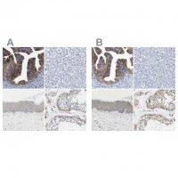 Anti-CCDC6 antibody produced in rabbit 