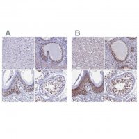 Anti-CCDC86 antibody produced in rabbit 