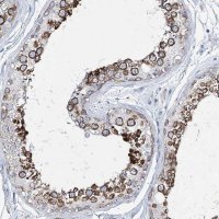 Anti-CCDC88A antibody produced in rabbit 