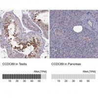 Anti-CCDC89 antibody produced in rabbit 