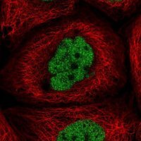 Anti-CCDC94 antibody produced in rabbit