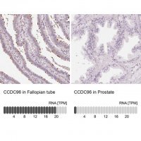 Anti-CCDC96 antibody produced in rabbit 
