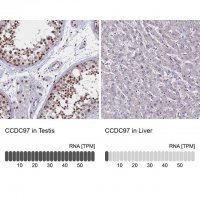 Anti-CCDC97 antibody produced in rabbit 
