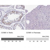Anti-CCNB1 antibody produced in rabbit 
