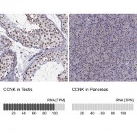 Anti-CCNK