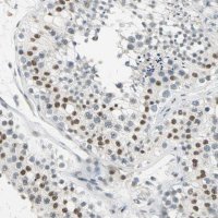 Anti-CCNT1 antibody produced in rabbit 