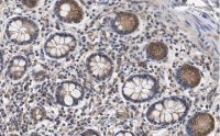 Anti-CCPG1 Antibody, clone 1F15 ZooMAb� Rabbit Monoclonal 