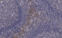 Anti-CCR2 Antibody, clone 5K5-3 ZooMAb� Rabbit Monoclonal 
