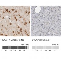 Anti-CCSAP antibody produced in rabbit 