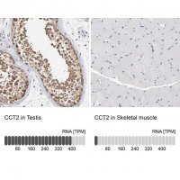 Anti-CCT2 antibody produced in rabbit 