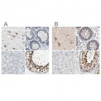 Anti-CCT5 antibody produced in rabbit
