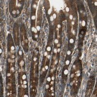 Anti-CCT7 antibody produced in rabbit 