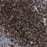 Anti-CD226 antibody produced in rabbit 