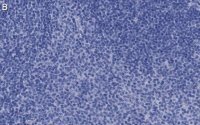 Anti-CD25 (IL2-RA) Antibody, clone 1K6 ZooMAb® Rabbit Monoclonal