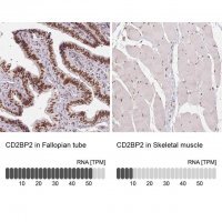 Anti-CD2BP2 antibody produced in rabbit 