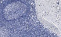 Anti-CD31 Antibody, clone 4E20 , ZooMAb� Rabbit Monoclonal 