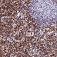 Anti-CD5 antibody produced in rabbit 