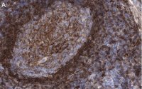 Anti-CD73 (NT5E) Antibody, clone 1F22 ZooMAb� Rabbit Monoclonal 
