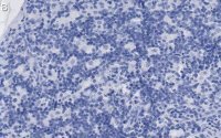 Anti-CD8 Antibody, clone 1H21 ZooMAb� Rabbit Monoclonal 