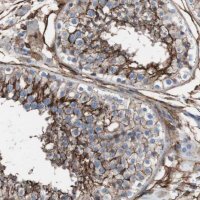 Anti-CD81 antibody produced in rabbit 