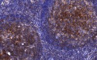 Anti-CD81 Antibody, clone 1C23 ZooMAb� Rabbit Monoclonal 