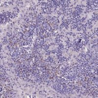 Anti-CD96 antibody produced in rabbit 