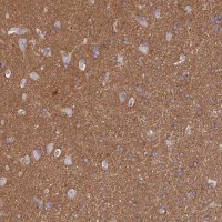 Anti-CD99L2 antibody produced in rabbit HPA038782-100UL