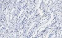 Anti-CDC5L Antibody, clone 4F8 ZooMAb� Rabbit Monoclonal 