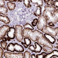 Anti-CDH16 antibody produced in rabbit