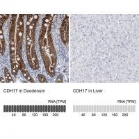 Anti-CDH17 antibody produced in rabbit