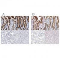 Anti-CDH17 antibody produced in rabbit