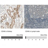 Anti-CDH6 antibody produced in rabbit 