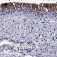 Anti-CDHR3 antibody produced in rabbit 